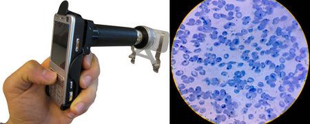 cellscope1 thumb 450x180